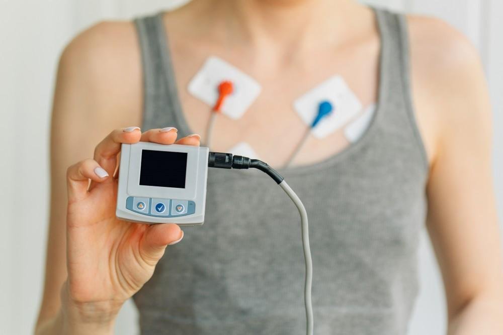 Holter Monitoring