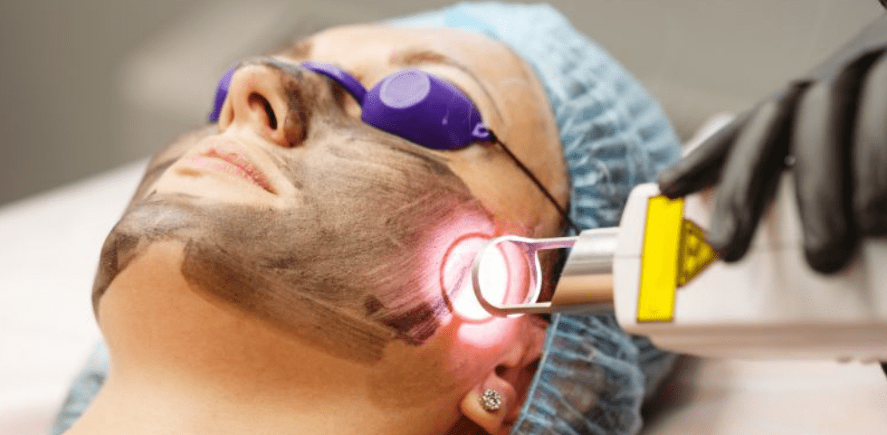 Laser Treatment